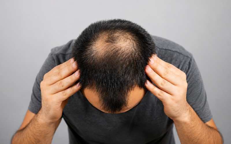 Hair fall treatment in Nellore at Sri Skin and Hair Clinic
